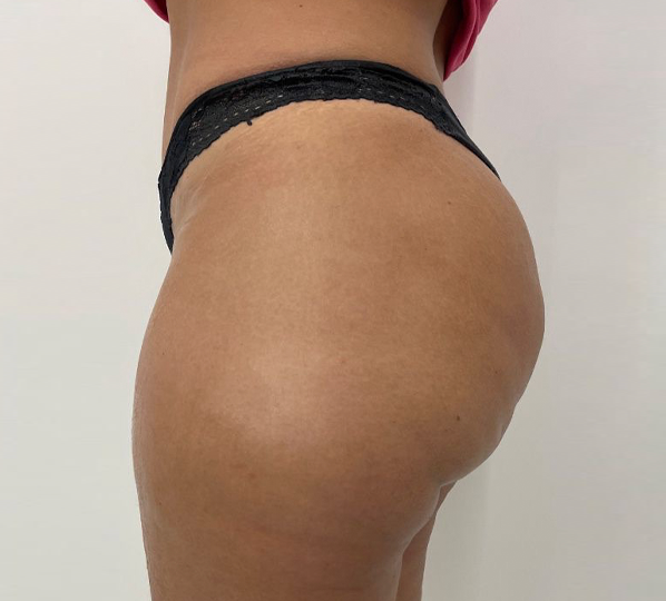 bumbum-1-b